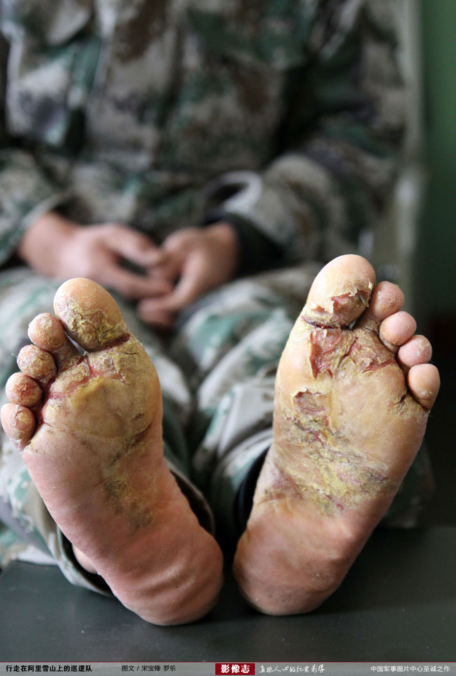 图一双脚应该向他敬礼按群众要求标示下不要吃东西可能影响你的胃口