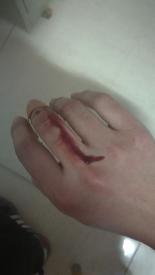 手坏了挑战过不了了怎么办