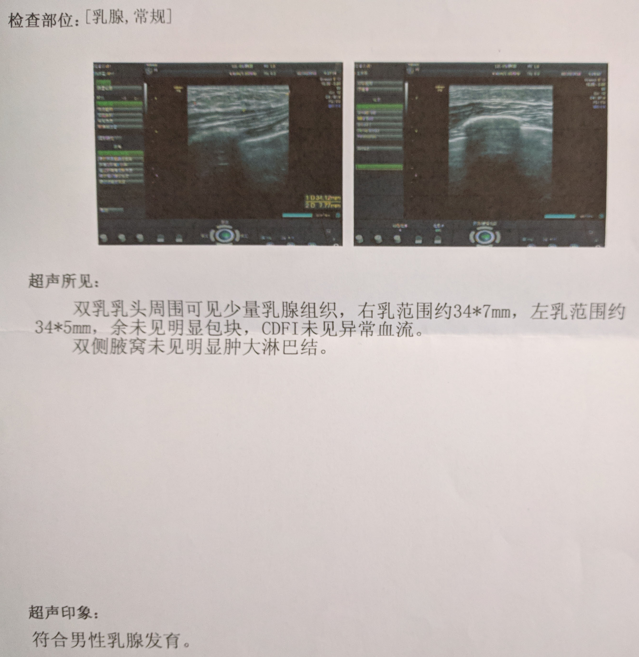 冒着社会性死亡的风险上奶照,问下关于男性乳头雌化的问题