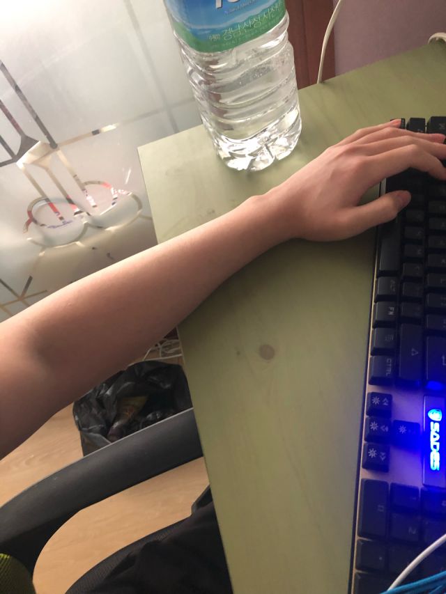 [老问题求助]关于手臂流姿势