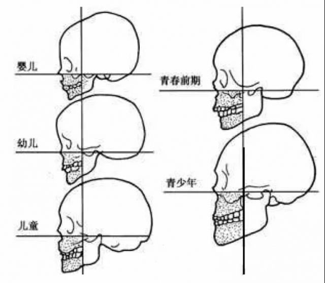 颅面比图片