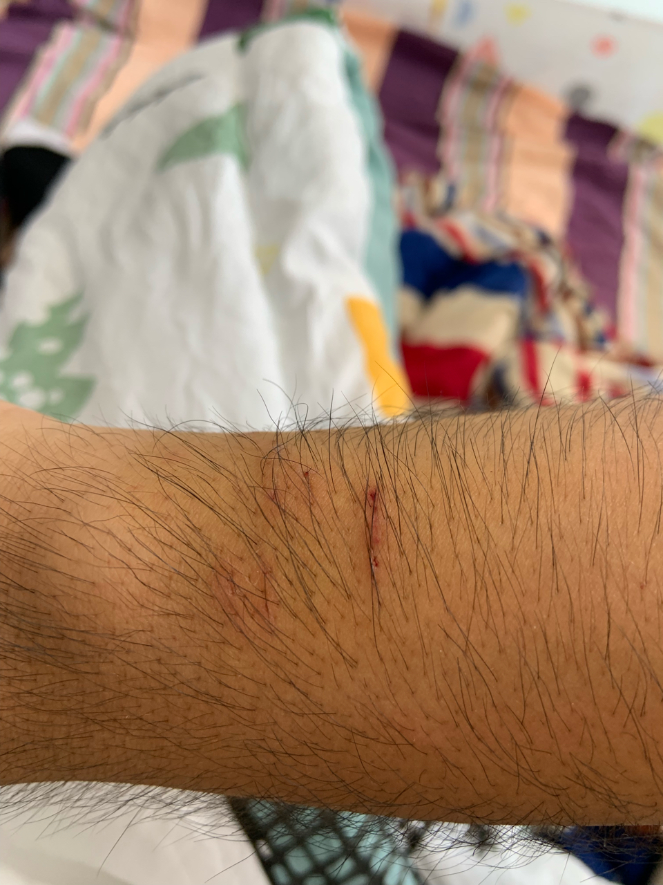 求助被打过针的猫咪咬伤出血了要去打狂犬疫苗不