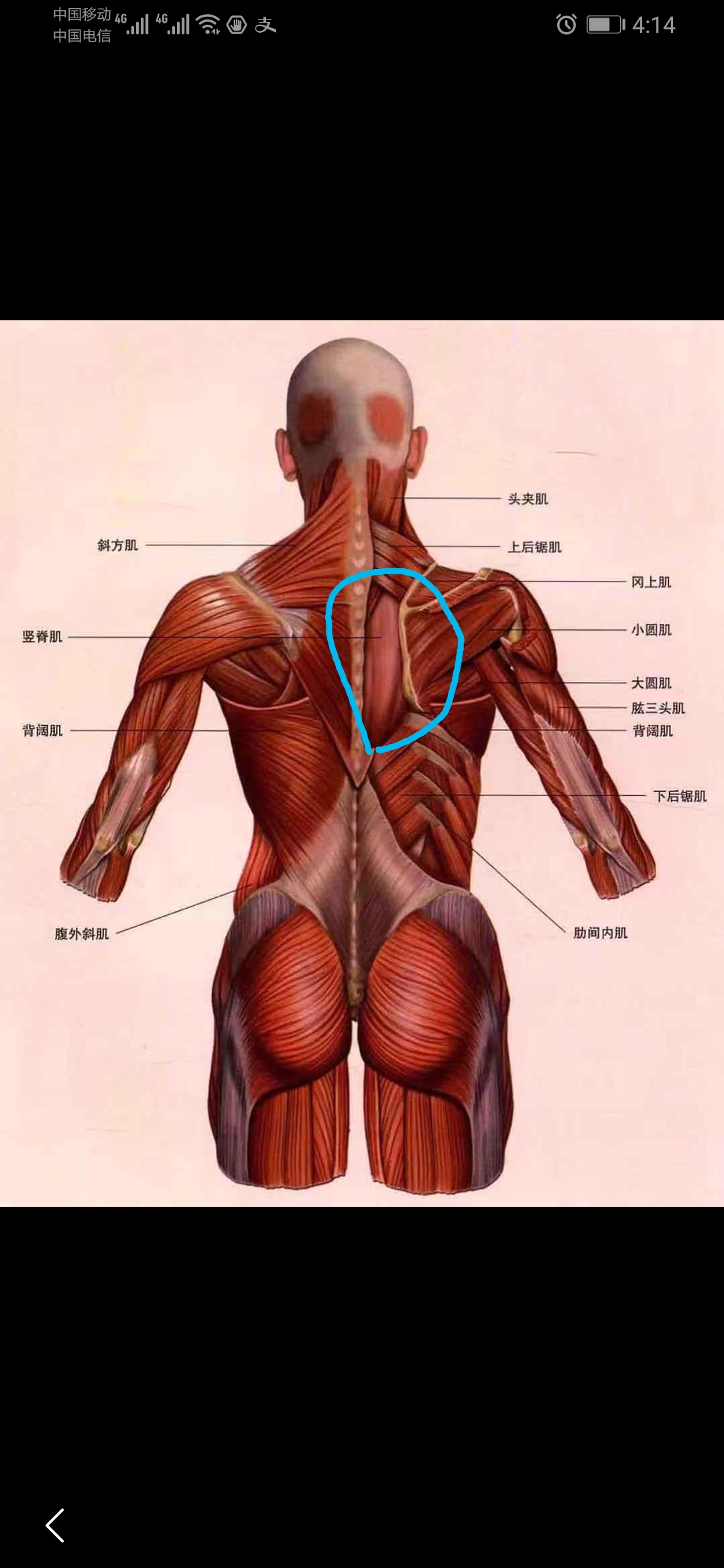 背部筋膜炎位置示意图图片