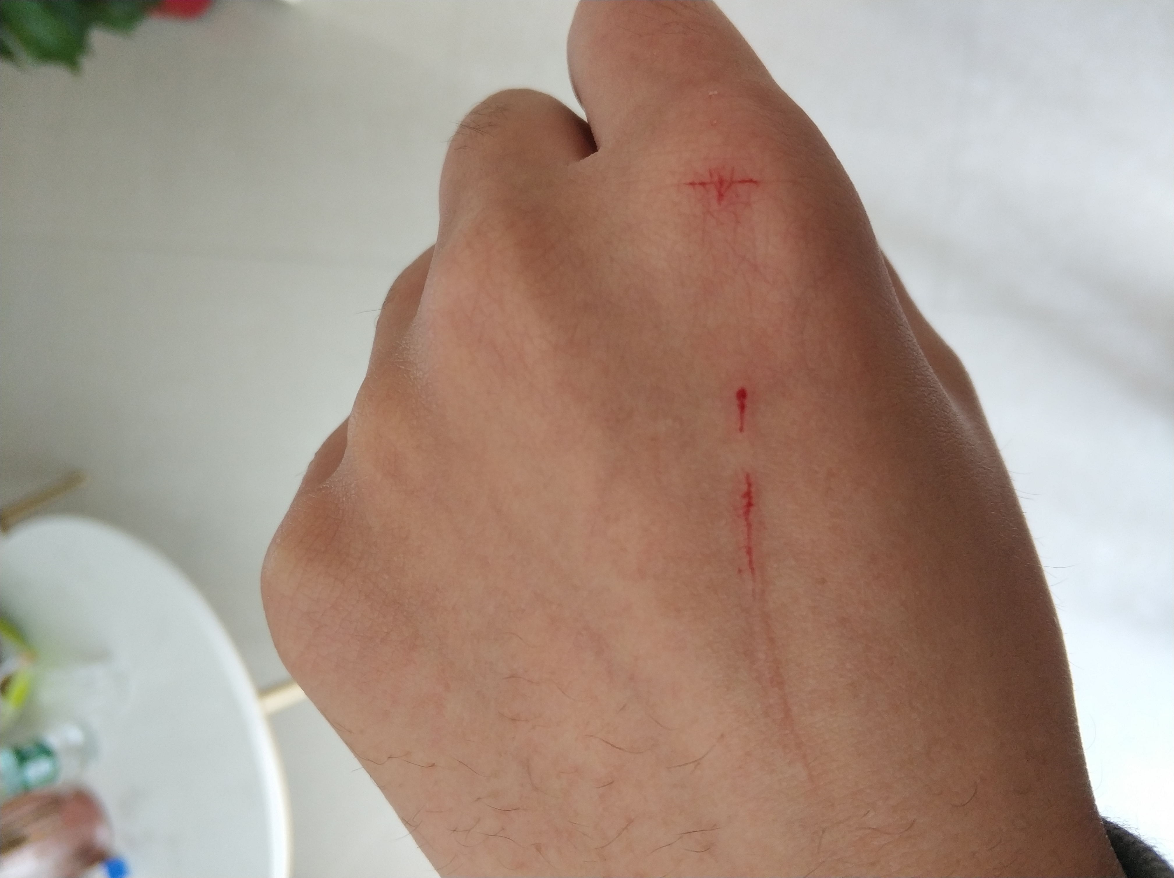 被小猫抓破了咋办有照片