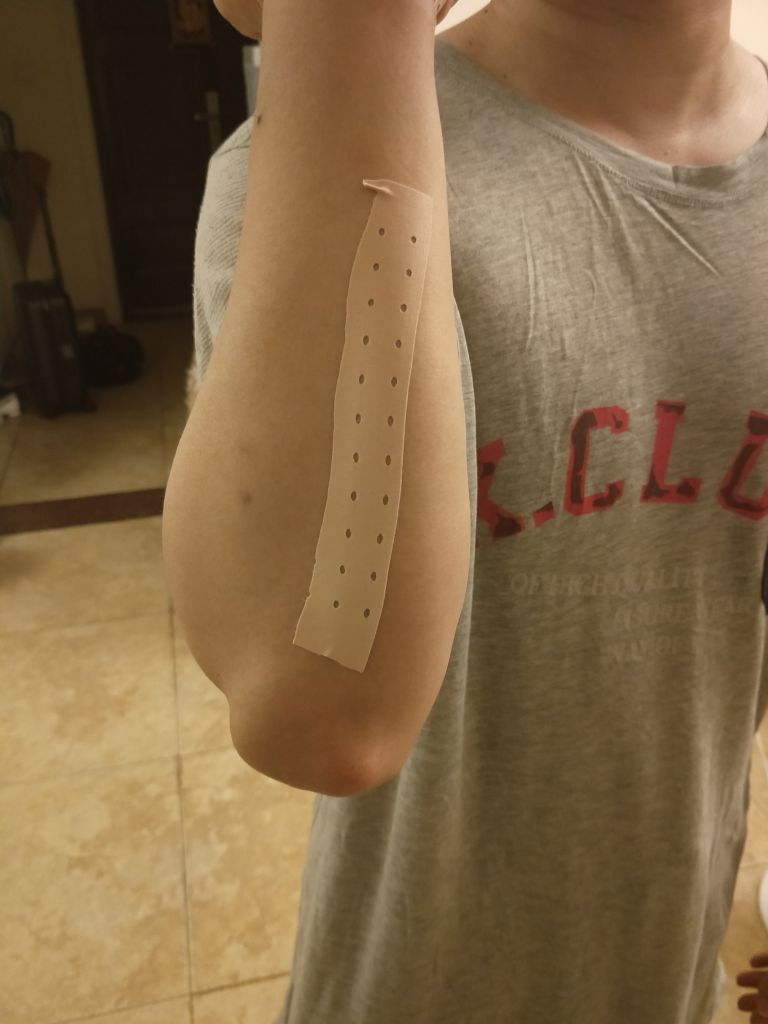 求助损伤练二头时用曲杆杠铃弯举的时候小臂的肌肉痛死啥原因