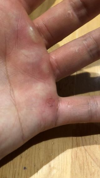 健身相关撸铁怎么预防手起茧以及跑步怎么起手