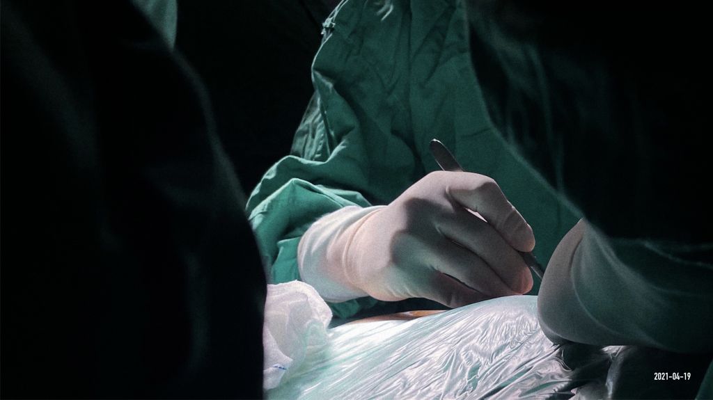 医学摄影一个外科医生视角的手术摄影