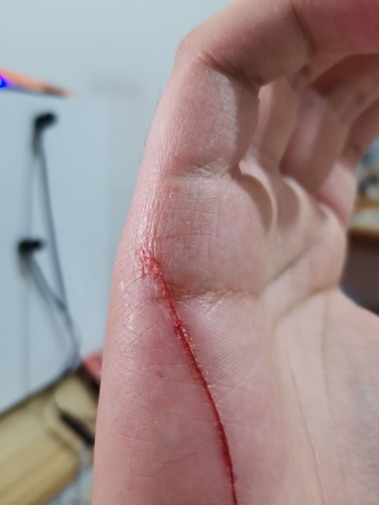 被猫挠伤需要打疫苗吗