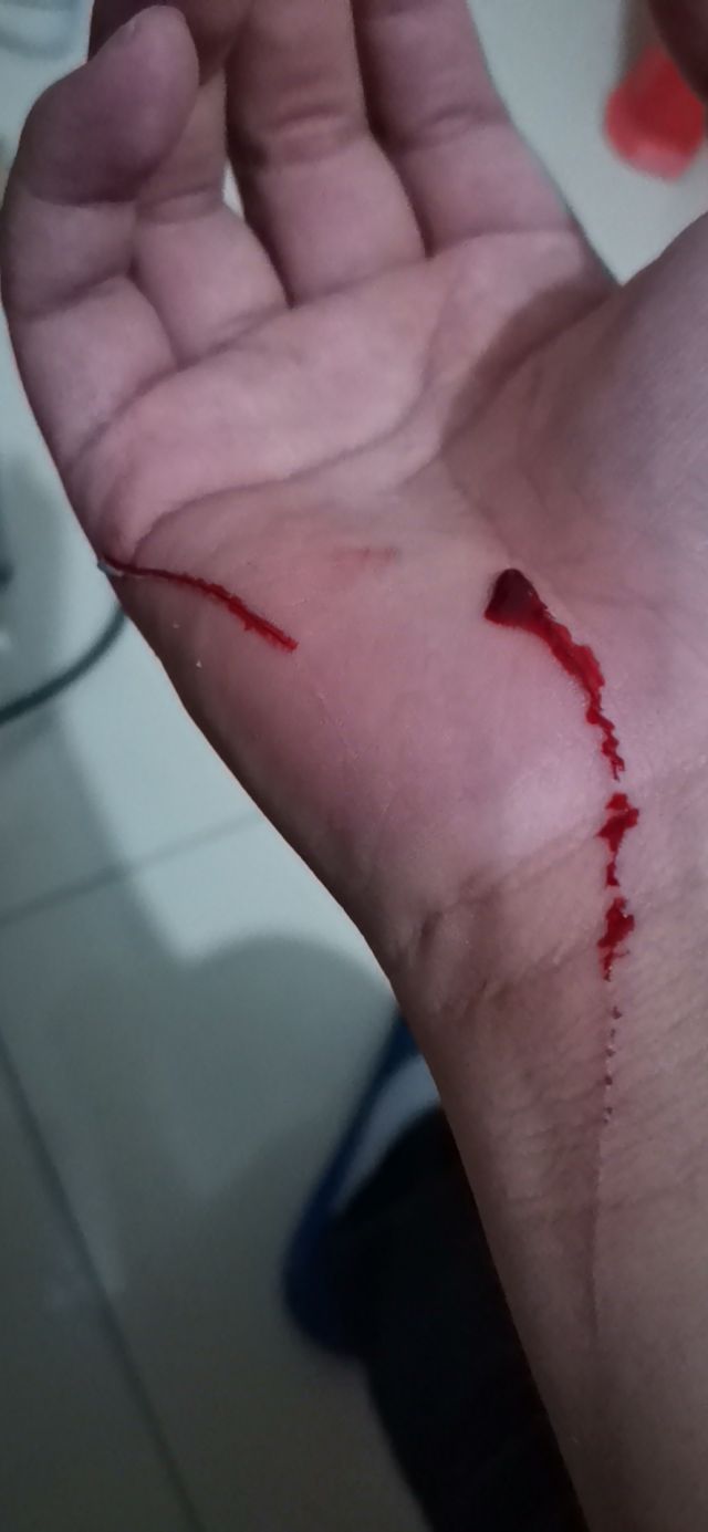 被猫挠伤需要打疫苗吗