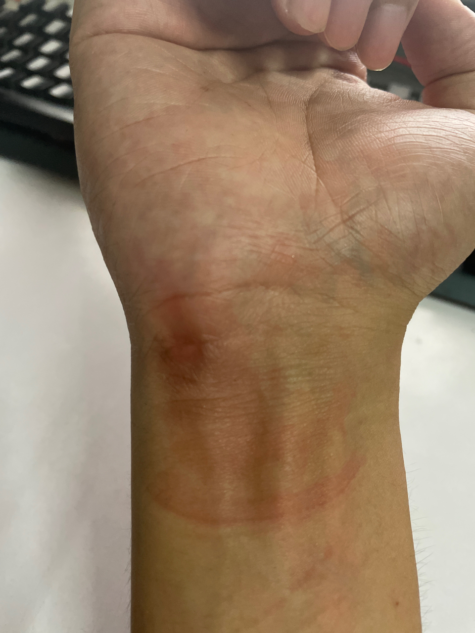 手腕内侧硌红了