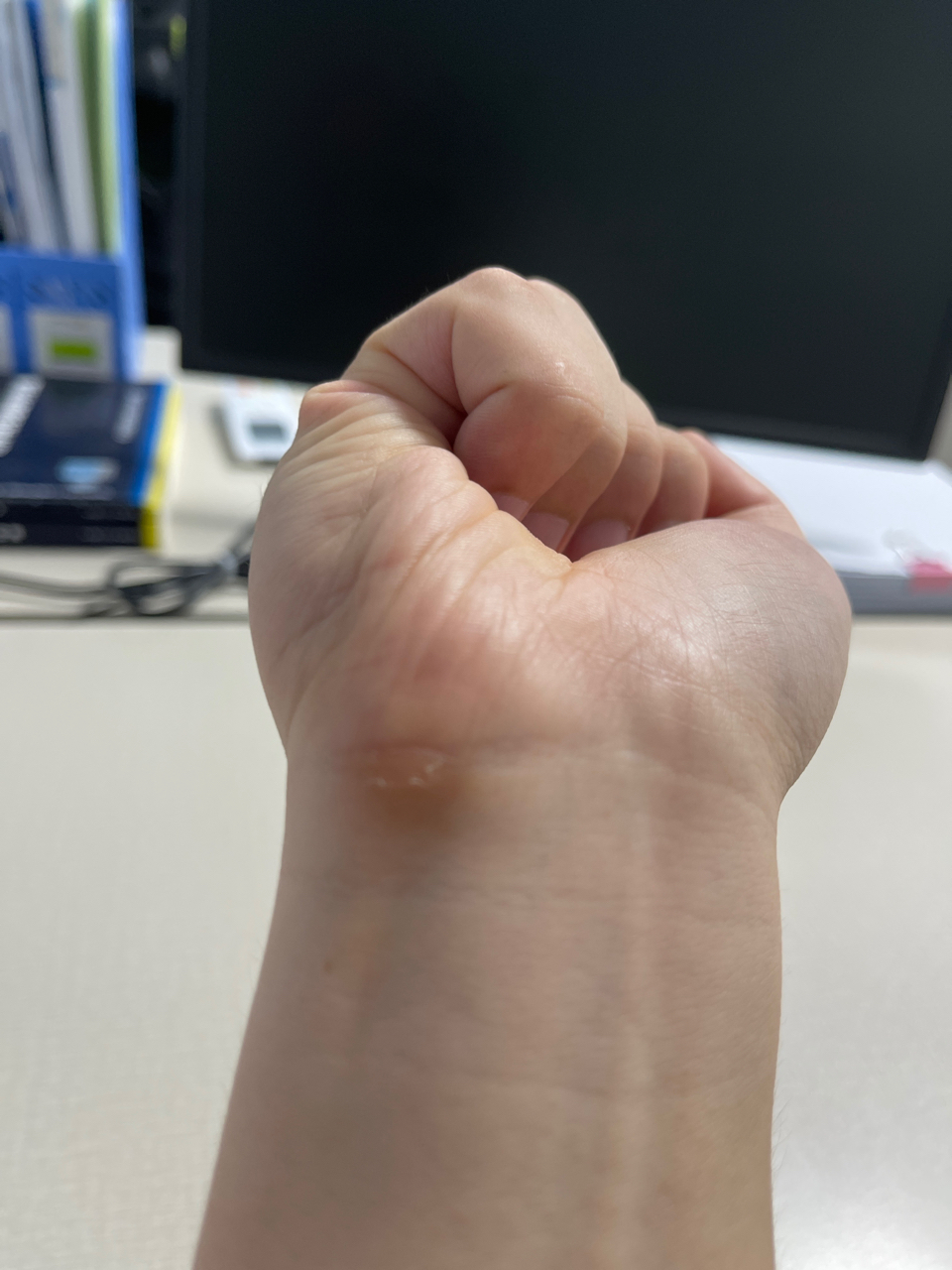手腕内侧硌红了
