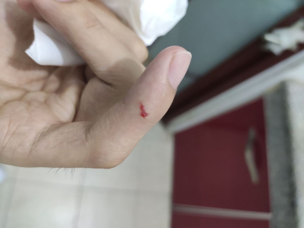 [求助氵]被猫咬了,该打哪几种疫苗求指点(内有伤口图)