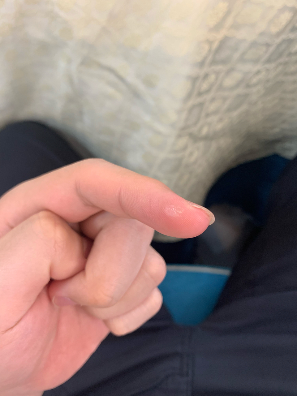 就尼玛离谱啊,食指边缘都能长茧……手心长茧也就算了,大家有什么产品