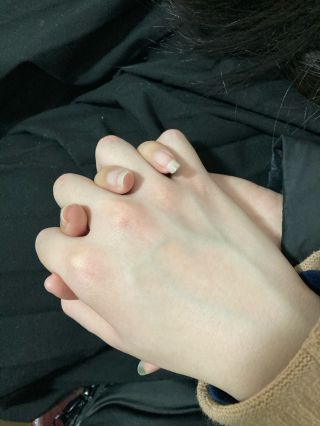 请问下正确的牵手姿势还有出汗怎么整