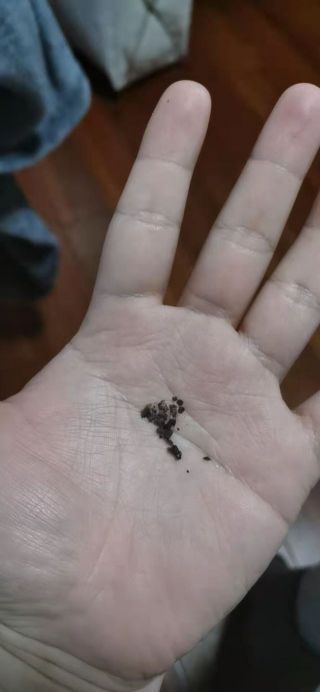 这猫耳屎比我都多洗了三天少不少了