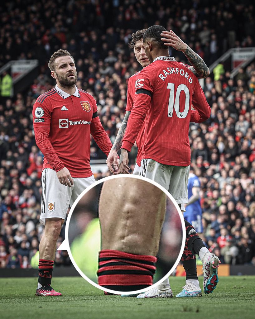 (转自微博)卢克肖:我差点就失去右腿