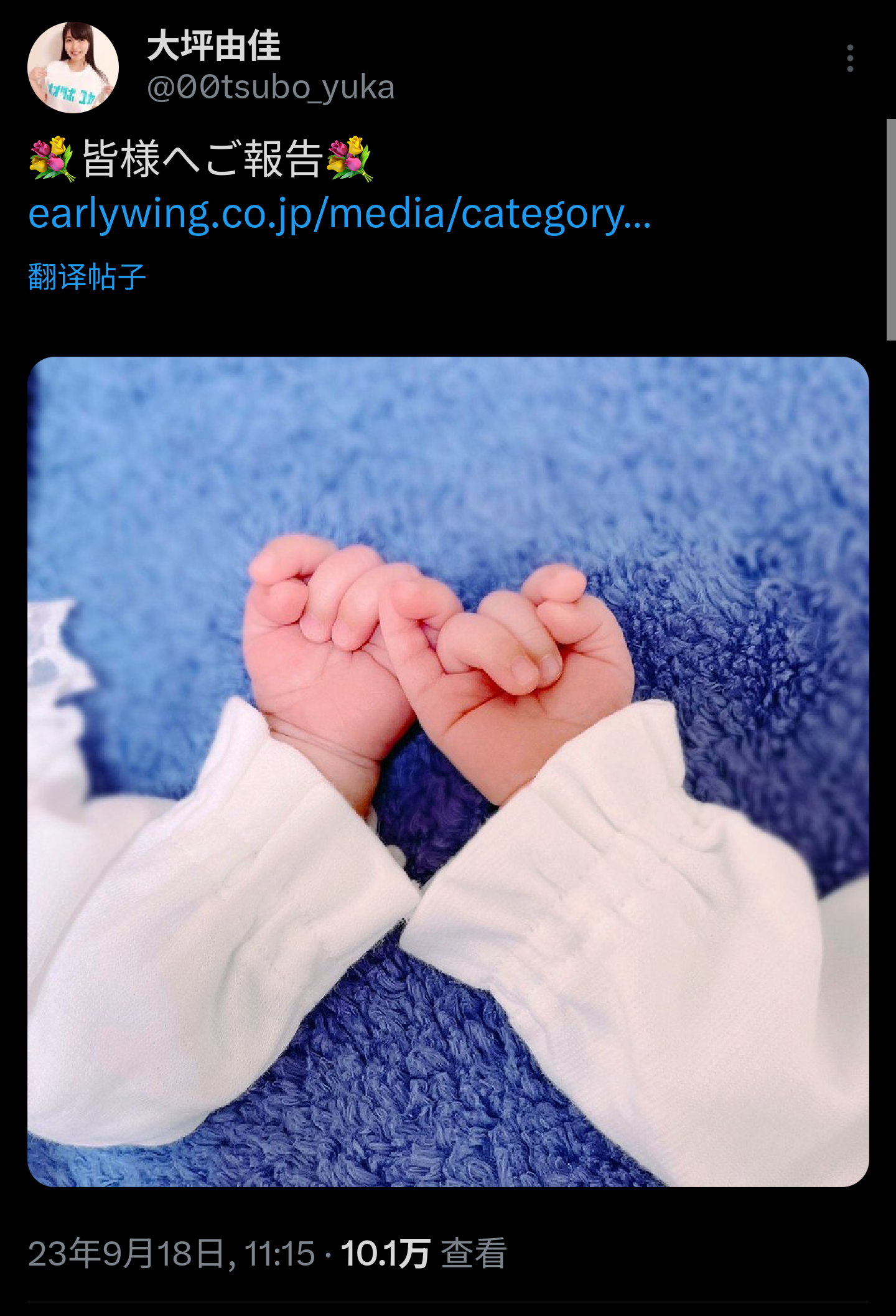 喜报大坪由佳顺利诞下双胞胎