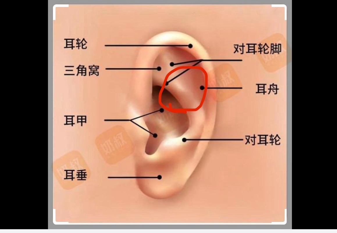 刚入手了airpodspro遇到了物理上的不兼容问题