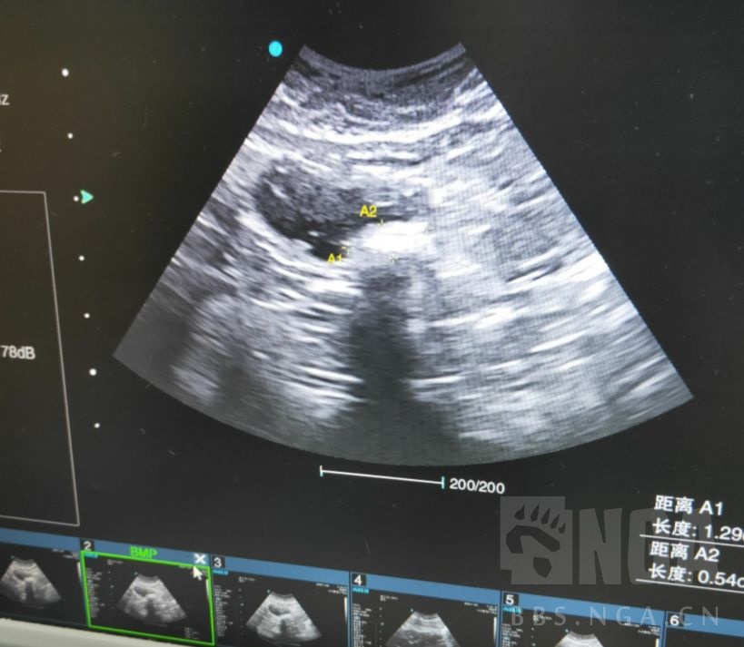 求助 猫猫尿频轻微尿血 怀疑是这两天降温太快 应激性膀胱炎nga玩家社区