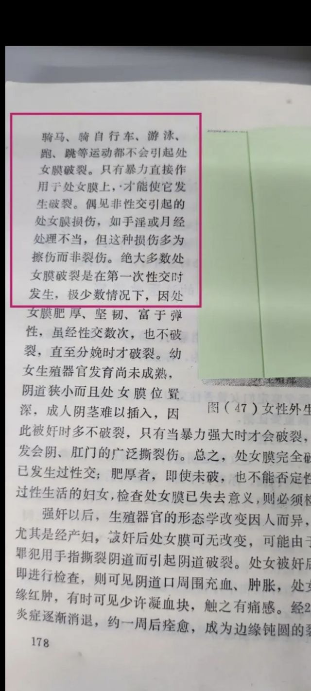 处女膜 上点法医学教材，关于处女膜的事情178